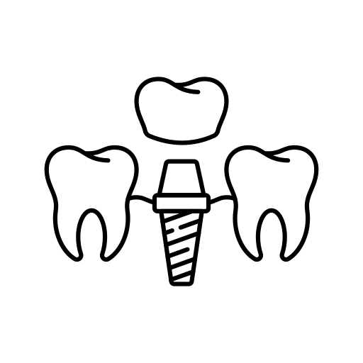 Імплантація